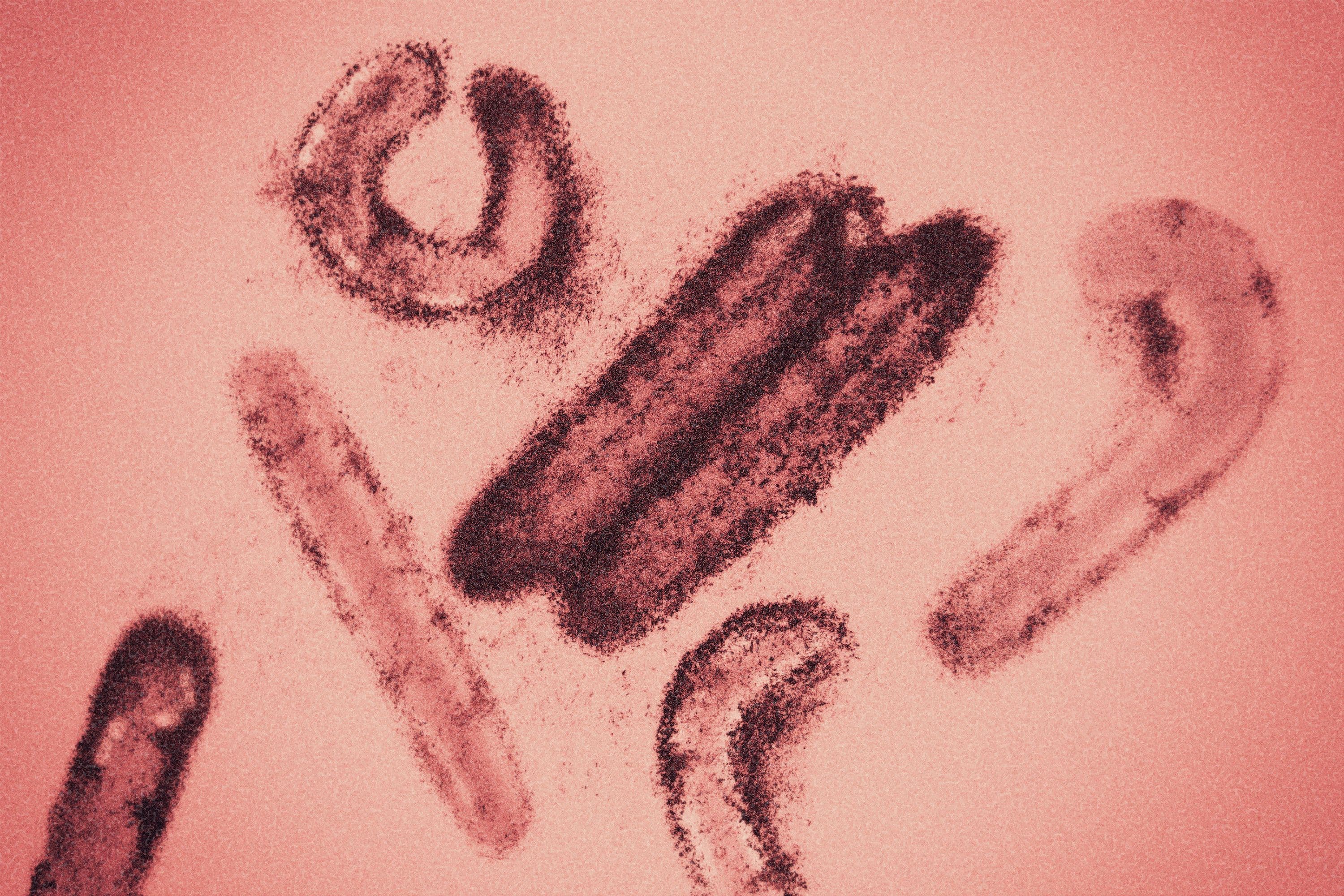 Colored image of the Marburg virus under the electron microscope